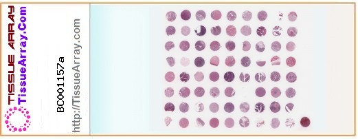 TissueArray.Com Tissue Array BC001157a