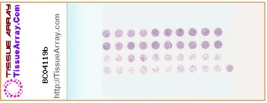 TissueArray.Com Tissue Array BC04119b