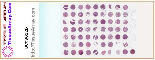 TissueArray.Com Tissue Array BC09012b