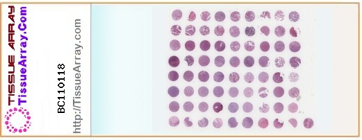 TissueArray.Com Tissue Array BC110118