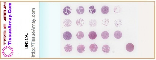 TissueArray.Com Tissue Array BN119a