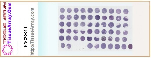 TissueArray.Com Tissue Array BNC20011