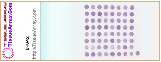 TissueArray.Com Tissue Array BR642