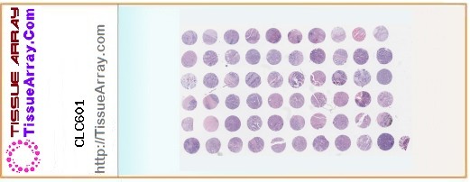 TissueArray.Com Tissue Array CLC601