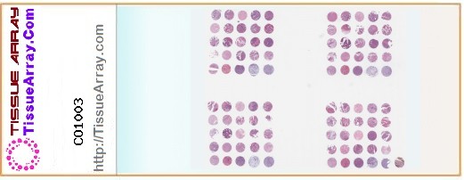 TissueArray.Com Tissue Array CO1003