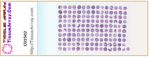 TissueArray.Com Tissue Array CO1502