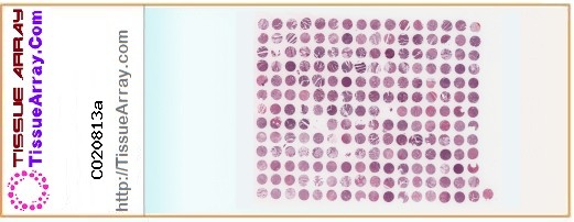 TissueArray.Com Tissue Array CO20813a