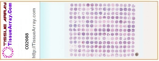 TissueArray.Com Tissue Array CO2088