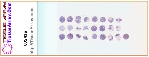 TissueArray.Com Tissue Array CO241a