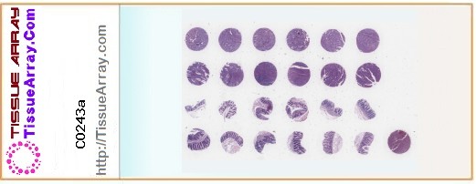 TissueArray.Com Tissue Array CO243a