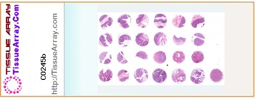 TissueArray.Com Tissue Array CO245b