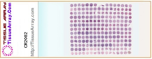 TissueArray.Com Tissue Array CR2082