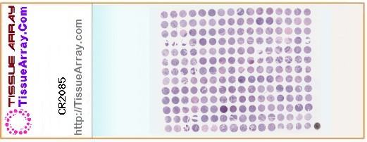 TissueArray.Com Tissue Array CR2085