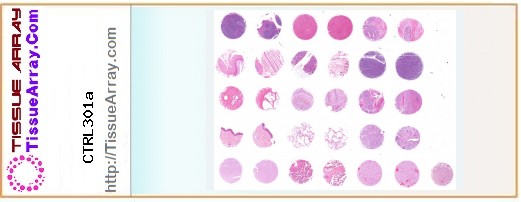 TissueArray.Com Tissue Array CTRL301a