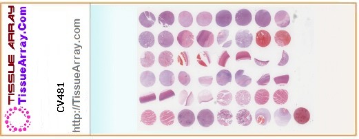 TissueArray.Com Tissue Array CV481