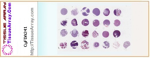 TissueArray.Com Tissue Array CyFDA241