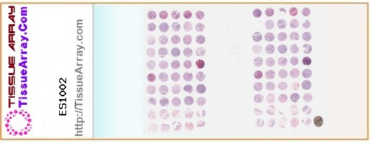 TissueArray.Com Tissue Array ES1002