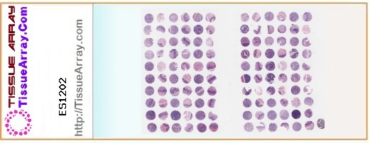 TissueArray.Com Tissue Array ES1202