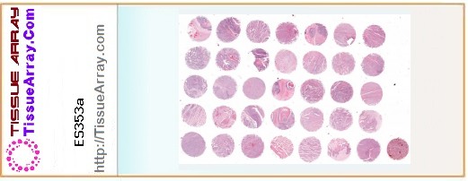 TissueArray.Com Tissue Array ES353a