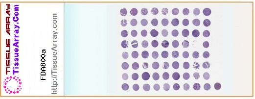 TissueArray.Com Tissue Array FDA800a