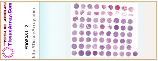 TissueArray.Com Tissue Array FDA808l-2