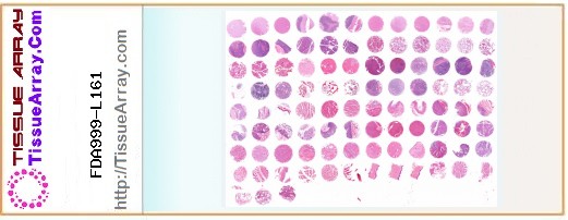 TissueArray.Com Tissue Array FDA999-L161