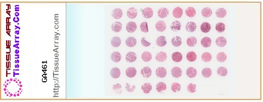 TissueArray.Com Tissue Array GA461