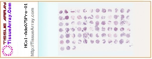 TissueArray.Com Tissue Array HCol-Ade075Pre-01