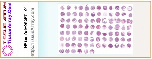 TissueArray.Com Tissue Array HStm-Ade090PG-01