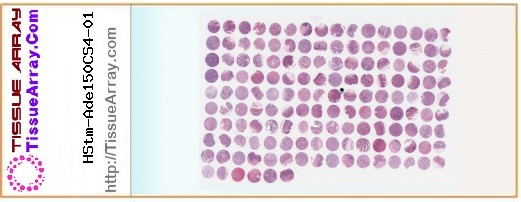 TissueArray.Com Tissue Array HStm-Ade150CS4-01