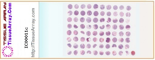 TissueArray.Com Tissue Array IC00011c