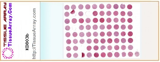 TissueArray.Com Tissue Array KD803b