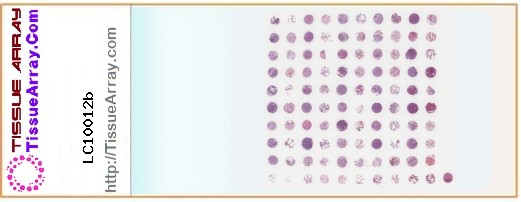 TissueArray.Com Tissue Array LC10012b