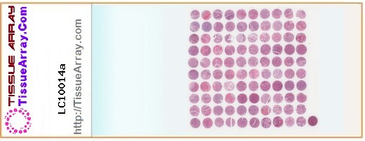 TissueArray.Com Tissue Array LC10014a