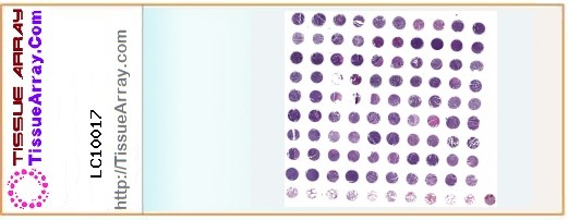 TissueArray.Com Tissue Array LC10017