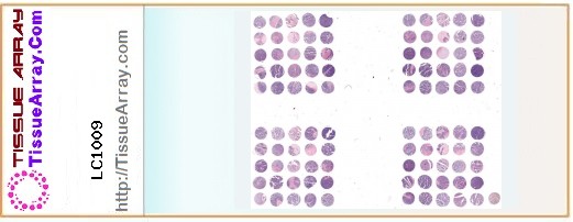 TissueArray.Com Tissue Array LC1009