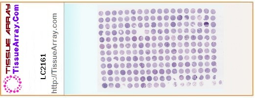 TissueArray.Com Tissue Array LC2161