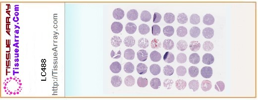 TissueArray.Com Tissue Array LC488