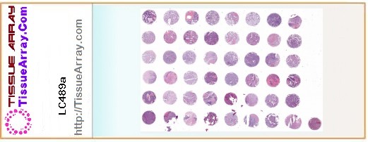 TissueArray.Com Tissue Array LC489a
