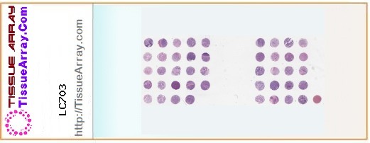 TissueArray.Com Tissue Array LC703