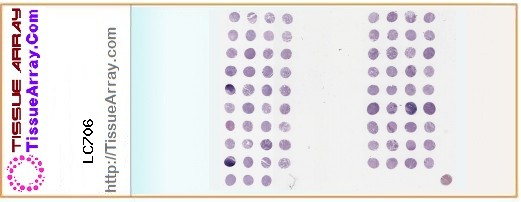 TissueArray.Com Tissue Array LC706