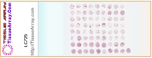 TissueArray.Com Tissue Array LC725