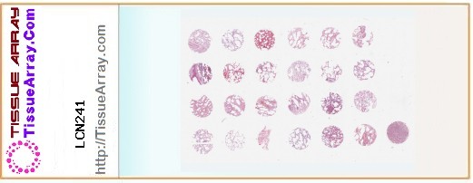 TissueArray.Com Tissue Array LCN241