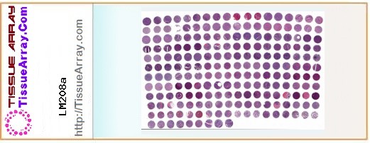 TissueArray.Com Tissue Array LM208a