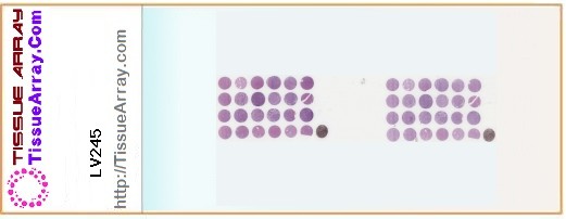 TissueArray.Com Tissue Array LV245