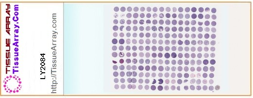 TissueArray.Com Tissue Array LY2084