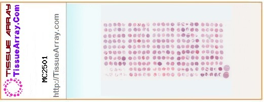 TissueArray.Com Tissue Array MC2501