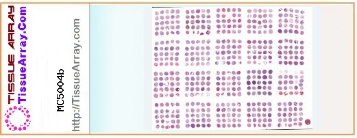 TissueArray.Com Tissue Array MC5004b