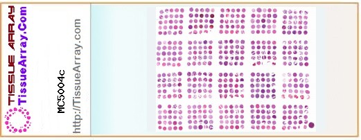 TissueArray.Com Tissue Array MC5004c