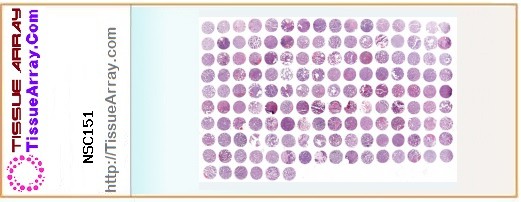 TissueArray.Com Tissue Array NSC151